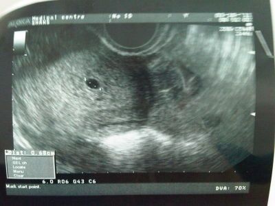 http://static1.babysfera.ru/3/9/0/0/38490024.400.jpeg
