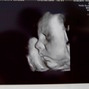 Фотографии УЗИ на 32-й неделе беременности