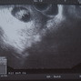 Фотографии УЗИ на 8-й неделе беременности