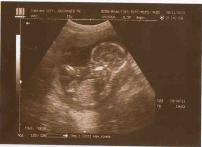 http://static1.babysfera.ru/b/a/2/a/14889612.400.jpeg