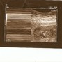 Фотографии УЗИ на 11-й неделе беременности