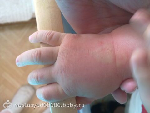 Болит грудь как при приливах