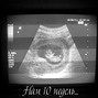 Фотографии УЗИ на 10-й неделе беременности